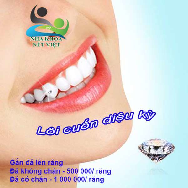 Nha khoa Nét Việt